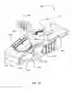 Fig. 52 - Surgical stapler for aortic anastomosis