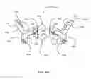 Fig. 59 - Surgical stapler for aortic anastomosis