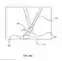 Fig. 64 - Surgical stapler for aortic anastomosis