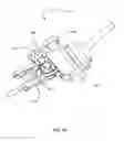 Fig. 65 - Surgical stapler for aortic anastomosis