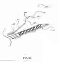 Fig. 69 - Surgical stapler for aortic anastomosis