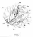 Fig. 75 - Surgical stapler for aortic anastomosis