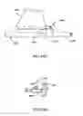Fig. 76 - Surgical stapler for aortic anastomosis
