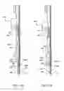 Fig. 81 - Surgical stapler for aortic anastomosis