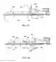 Fig. 88 - Surgical stapler for aortic anastomosis