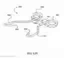 Fig. 89 - Surgical stapler for aortic anastomosis