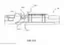 Fig. 91 - Surgical stapler for aortic anastomosis