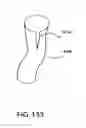 Fig. 93 - Surgical stapler for aortic anastomosis