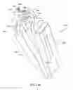 Fig. 96 - Surgical stapler for aortic anastomosis
