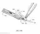 Fig. 98 - Surgical stapler for aortic anastomosis
