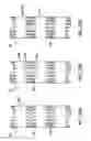 Fig. 07 - Selective aortic balloon occlusion device, methods of use, and uses thereof