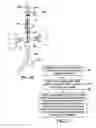 Fig. 09 - Selective aortic balloon occlusion device, methods of use, and uses thereof