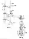 Fig. 03 - Narrow profile balloon for use with an occlusion device, methods of use, and uses thereof