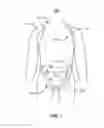 Fig. 02 - Hemorrhage control device