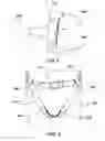 Fig. 03 - Hemorrhage control device