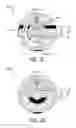 Fig. 04 - SYSTEM FOR PERFORMING INTRALUMINAL HISTOTRIPSY AND METHOD OF OPERATION THEREOF