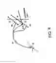 Fig. 06 - Minimally invasive surgical assembly and methods