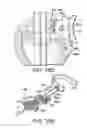 Fig. 16 - Minimally invasive surgical assembly and methods