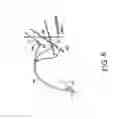 Fig. 06 - Minimally invasive surgical assembly and methods