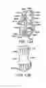 Fig. 12 - Minimally invasive surgical assembly and methods