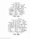 Fig. 14 - Minimally invasive surgical assembly and methods