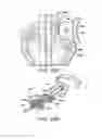 Fig. 16 - Minimally invasive surgical assembly and methods