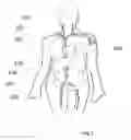 Fig. 02 - SYSTEM AND METHOD FOR TREATING HEPATIC AREA VEIN OCCLUSION