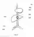 Fig. 04 - SYSTEM AND METHOD FOR TREATING HEPATIC AREA VEIN OCCLUSION