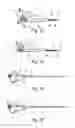 Fig. 06 - Snare instrument with a distal snare structure