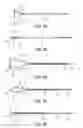 Fig. 12 - Snare instrument with a distal snare structure
