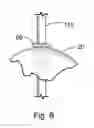 Fig. 07 - INSTRUMENT DOCKING PORTS FOR TRANS-ENDOSCOPIC AND LAPAROSCOPIC SURGERY ACCESS PORTS
