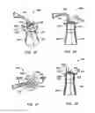 Fig. 14 - SURGICAL PORT ASSEMBLY