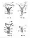 Fig. 16 - SURGICAL PORT ASSEMBLY