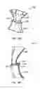 Fig. 24 - SURGICAL PORT ASSEMBLY