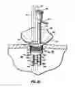 Fig. 30 - SURGICAL PORT ASSEMBLY