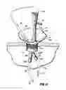 Fig. 33 - SURGICAL PORT ASSEMBLY