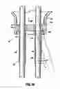 Fig. 34 - SURGICAL PORT ASSEMBLY