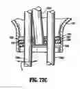 Fig. 41 - SURGICAL PORT ASSEMBLY