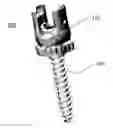 Fig. 01 - Self in-fusing pedicle screw implant