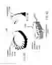 Fig. 06 - Self in-fusing pedicle screw implant