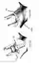 Fig. 18 - Self in-fusing pedicle screw implant
