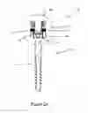 Fig. 03 - SPINAL SCREWS AND METHODS OF USING THE SAME