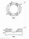 Fig. 04 - Modular uniplanar pedicle screw assembly for use with a polyaxial bone fastener