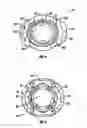 Fig. 06 - Modular uniplanar pedicle screw assembly for use with a polyaxial bone fastener