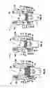 Fig. 08 - Modular uniplanar pedicle screw assembly for use with a polyaxial bone fastener