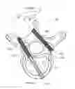 Fig. 01 - Pedicle screw placement system and method for spinal surgery