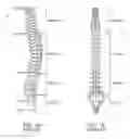 Fig. 02 - Pedicle screw placement system and method for spinal surgery