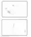 Fig. 06 - Method for deploying a fusion device for sacroiliac joint fusion