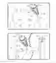 Fig. 11 - Method for deploying a fusion device for sacroiliac joint fusion