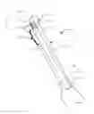 Fig. 01 - System and method for altering rotational alignment of bone sections